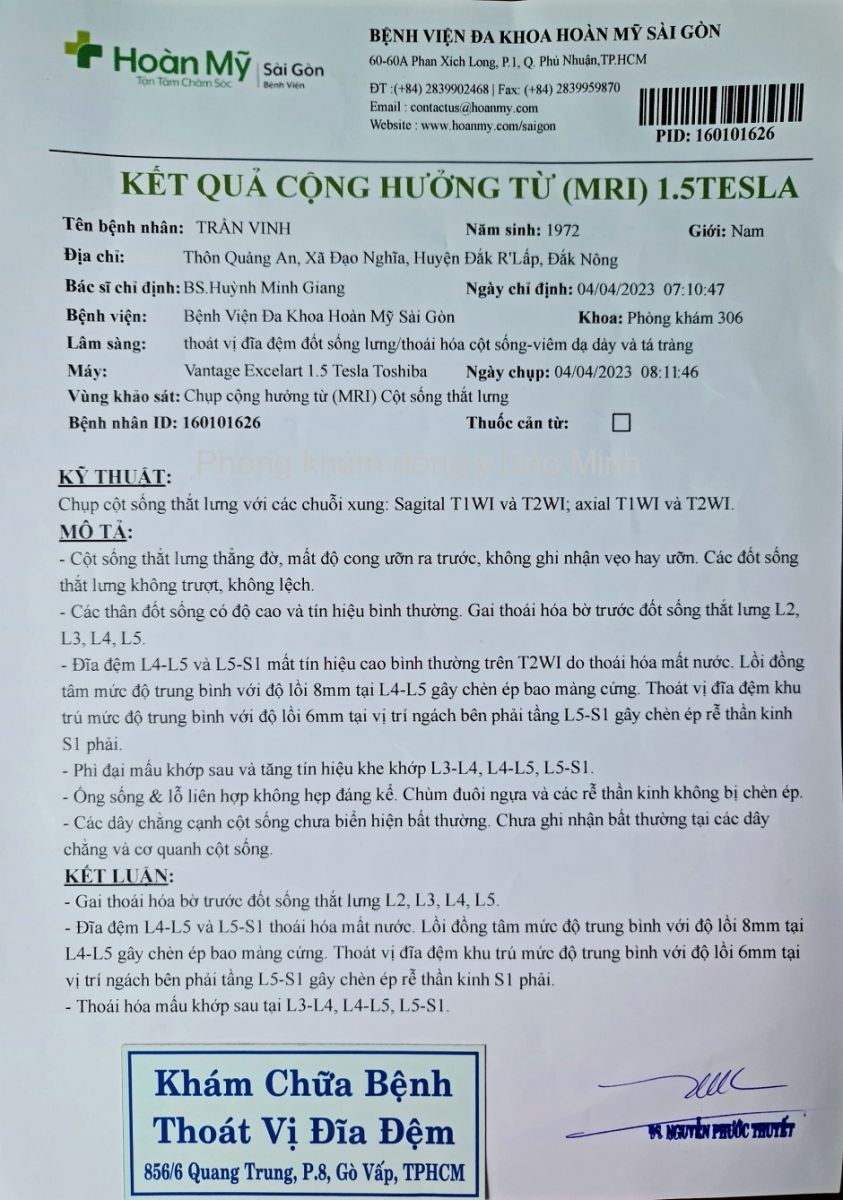 Thoát vị đĩa đệm có nên mổ không